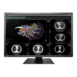 EIZO RadiForce RX660 - Monitor a LED - 6MP - colore - 30" - 3280 x 2048 - IPS - 1000 cd/m² - 1500:1 - 25 ms - DVI-D, 2xDisplayP